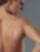 Medical laser hair removal for men